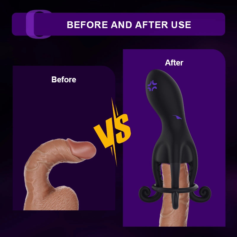 Male Masturbator & Penis Vibrator - 10 Vibration Modes, Wrapping Tentacle Design, Silicone, Waterproof, USB Charge - For Male Masturbator & Penis Vibrator - 10 Vibration Modes, Wrapping Tentacle Design, Silicone, Waterproof, USB Charge - For